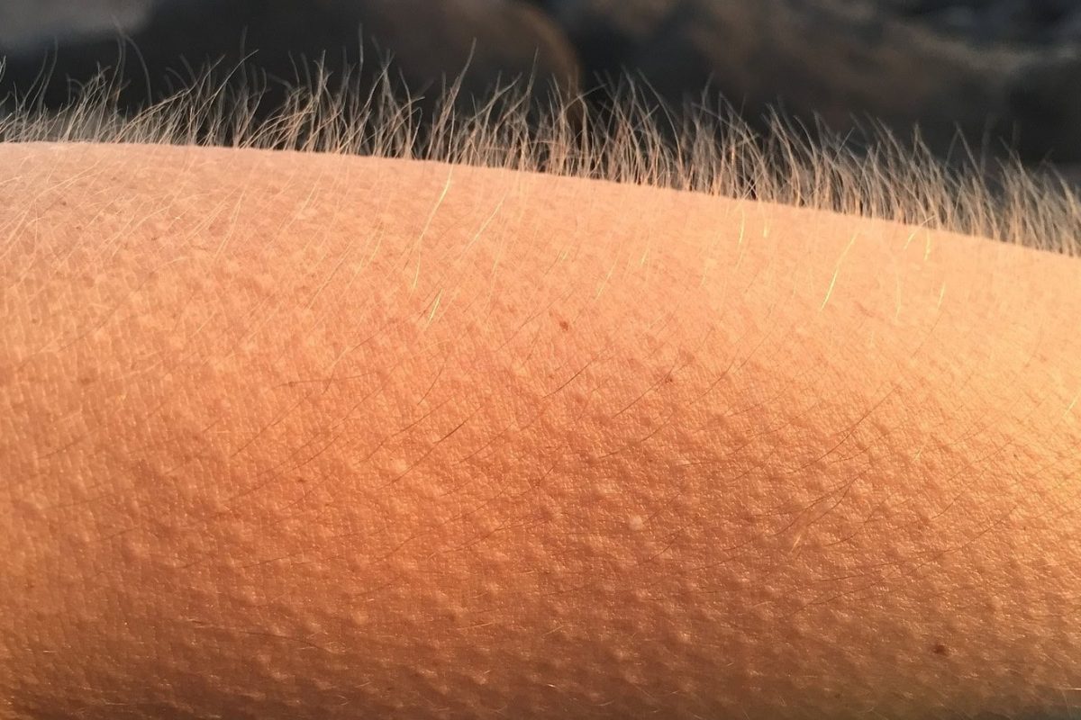 Blog-33.1-Gaensehaut-Goosebumps.jpg